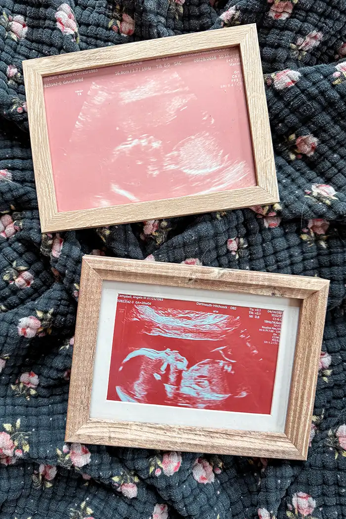 Ultrasound art featured image with two framed pink ultrasound art prints sitting on top of a blue floral muslin baby blanket